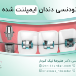 ارتودنسی دندان ایمپلنت شده: بعد ایمپلنت می‌توان ارتودنسی کرد؟